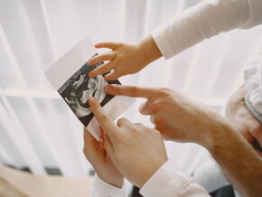 familia observa imagem de ultrassonografia sindrome edwards