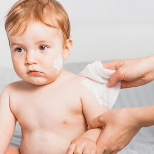 Imagem de mãe aplicando pomada em alergias na pele do bebê.