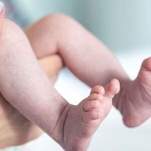 Mãos segurando as perninhas de um recém-nascido avaliando o índice de Apgar