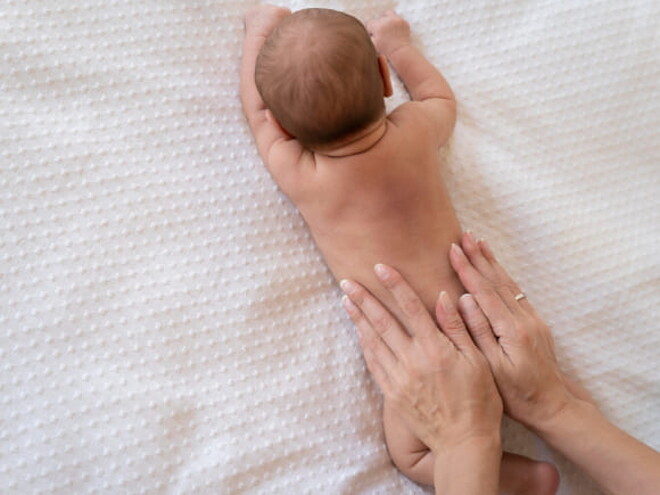 bebê com mancha mongólica nas costas deitado na cama