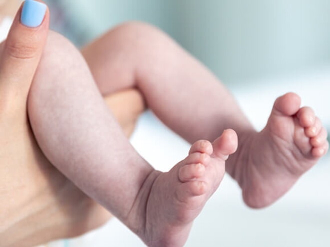 Mãos segurando as perninhas de um recém-nascido avaliando o índice de Apgar